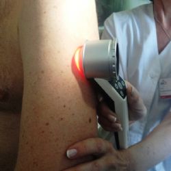 Den melanomu v jihlavské nemocnici - lékařka bude celý den prohlížet znaménka