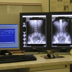 Novinka v brodské nemocnici