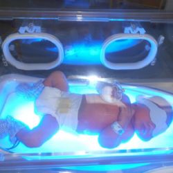 Nový přístroj pomůže v jihlavské nemocnici proti žloutence