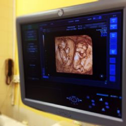 Nový ultrazvuk zpřesní diagnostiku a zrychlí rozhodování lékařů jihlavské nemocnice