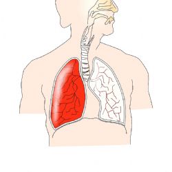 S respiračními onemocněními si poradí studená inhalace