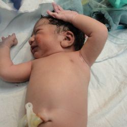 Podíl předčasně narozených dětí klesá