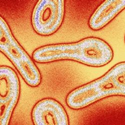 Záškrt po 55 letech zabil seniora na Vysočině